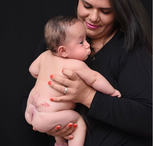 Cirurgias intrauterinas